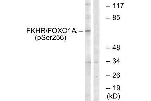 Western Blotting (WB) image for anti-Forkhead Box O1 (FOXO1) (pSer256) antibody (ABIN1847474) (FOXO1 antibody  (pSer256))
