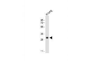 HLA-DPB1 antibody  (AA 77-105)