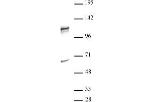 NFATC2 antibody (pAb) tested by Western blot. (NFAT1 antibody  (N-Term))