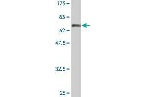 Western Blot detection against Immunogen (74. (Fatty Acid Synthase antibody  (AA 1-439))
