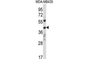 Western Blotting (WB) image for anti-Olfactory Receptor, Family 8, Subfamily K, Member 1 (OR8K1) antibody (ABIN2997661)
