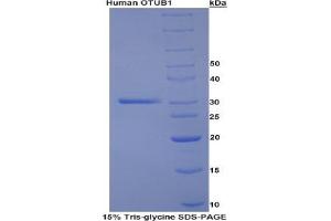 SDS-PAGE analysis of Human Otubain 1 Protein. (OTUB1 Protein)