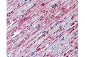 PNPT1 antibody was used for immunohistochemistry at a concentration of 4-8 ug/ml. (PNPT1 antibody  (Middle Region))
