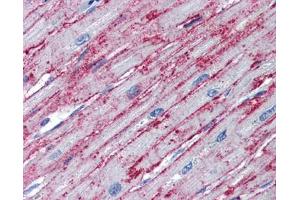 PNPT1 antibody was used for immunohistochemistry at a concentration of 4-8 ug/ml.