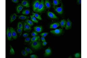 Immunofluorescence staining of A549 cells with ABIN7151851 at 1:400, counter-stained with DAPI. (EPH Receptor A7 antibody  (AA 28-182))