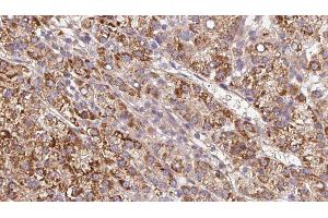 Immunohistochemistry (IHC) image for anti-Cholinergic Receptor, Nicotinic, beta 4 (Neuronal) (CHRNB4) (Internal Region) antibody (ABIN6260827)