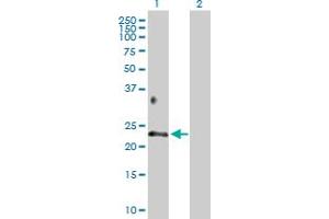 Western Blot analysis of BTC expression in transfected 293T cell line by BTC MaxPab polyclonal antibody.