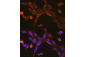 Immunofluorescence analysis of NIH-3T3 cells using MAVS Rabbit pAb (ABIN6132297, ABIN6143583, ABIN6143584 and ABIN6221441) at dilution of 1:100 (40x lens).
