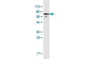 Western Blot detection against Immunogen (71. (WDFY3 antibody  (AA 1-420))