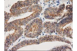 Image no. 1 for anti-Catenin (Cadherin-Associated Protein), beta 1, 88kDa (CTNNB1) antibody (ABIN1496889) (CTNNB1 antibody)