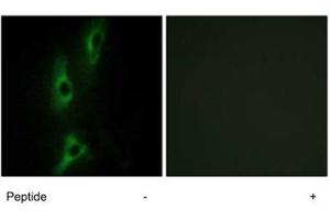 Immunofluorescence analysis of NIH/3T3 cells, using ADRB2 polyclonal antibody . (beta 2 Adrenergic Receptor antibody  (C-Term))