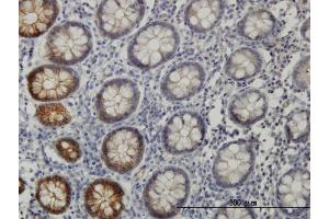 Immunoperoxidase of monoclonal antibody to EPHB3 on formalin-fixed paraffin-embedded human colon. (EPH Receptor B3 antibody  (AA 899-997))