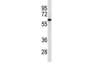 CAMKK2 western blot analysis in Jurkat lysate. (CAMKK2 antibody)