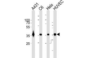 All lanes : Anti-GDH Antibody at 1:1000 dilution Lane 1: A431 whole cell lysates Lane 2: C6 whole cell lysates Lane 3: Hela whole cell lysates Lane 4: HUVEC whole cell lysates Lysates/proteins at 20 μg per lane. (GAPDH antibody)
