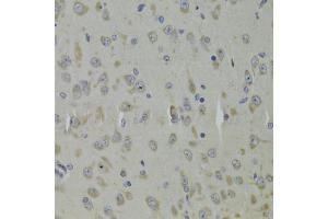 Immunohistochemistry of paraffin-embedded mouse brain using RPL9 Antibody. (RPL9 antibody)