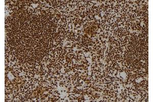 ABIN6264437 and ABIN6269102 at 1/100 staining Mouse spleen tissue by IHC-P. (Progesterone Receptor antibody  (Internal Region))