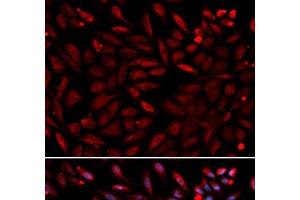 Immunofluorescence analysis of U2OS cells using PSMC2 Polyclonal Antibody (PSMC2 antibody)