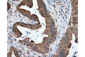 Immunohistochemical staining of paraffin-embedded liver tissue using anti-RC219453 mouse monoclonal antibody. (NPR3 antibody)