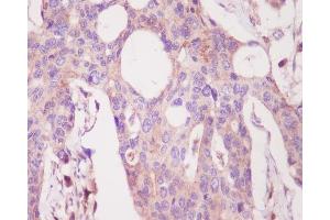Immunohistochemistry (Paraffin-embedded Sections) (IHC (p)) image for anti-Protein Kinase C, alpha (PKCa) antibody (ABIN7606874)