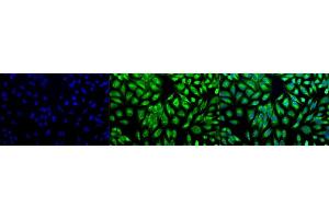 Immunocytochemistry/Immunofluorescence analysis using Rabbit Anti-PDI Polyclonal Antibody (ABIN361828 and ABIN361829). (P4HB antibody  (AA 409-509))