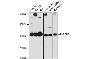 RHBDD1 antibody  (AA 206-315)