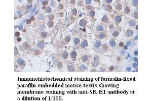 Image no. 1 for anti-Scavenger Receptor Class B, Member 1 (SCARB1) antibody (ABIN791178) (SCARB1 antibody)