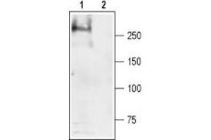 Western blot analysis of rat skeletal muscle lysate: - 1. (SCN4A antibody  (Intracellular))
