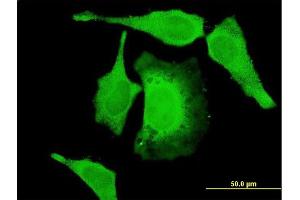Immunofluorescence of monoclonal antibody to PAN2 on HeLa cell. (PAN2 antibody  (AA 1099-1198))
