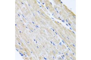 Immunohistochemistry of paraffin-embedded mouse heart using ABCB8 antibody at dilution of 1:100 (x40 lens). (ABCB8 antibody)