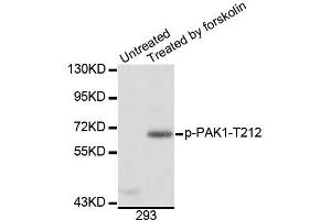 Western blot analysis of extracts of 293 cells, using Phospho-PAK1-T212 antibody (ABIN5996121). (PAK1 antibody  (pThr212))
