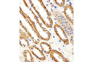 Immunohistochemical analysis of paraffin-embedded H. (Cystin 1 antibody  (C-Term))