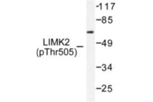 Image no. 1 for anti-LIM Domain Kinase 2 (LIMK2) (pThr505) antibody (ABIN318064) (LIMK2 antibody  (pThr505))