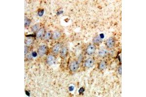 Immunohistochemical analysis of ABCB8 staining in rat brain formalin fixed paraffin embedded tissue section. (ABCB8 antibody)