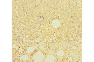 Immunohistochemistry of paraffin-embedded human adrenal gland tissue using ABIN7158146 at dilution of 1:100 (LRRC19 antibody  (AA 25-270))
