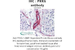 Image no. 3 for anti-PRKG antibody (ABIN1738352) (PRKG antibody)