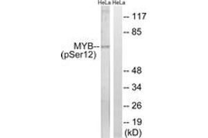 Western blot analysis of extracts from HeLa cells treated with Hu 2nM 24h, using MYB (Phospho-Ser12) Antibody. (MYB antibody  (pSer12))