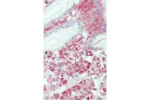Immunohistochemical staining of human stomach (A) and human adrenal gland (B) with SLC7A2 polyclonal antibody . (SLC7A2 antibody  (Internal Region))