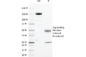 SDS-PAGE Analysis Purified HLA-DRA Mouse Monoclonal Antibody (169-1B5. (HLA-DRA antibody)