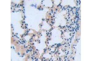 IHC-P analysis of Mouse Tissue, with DAB staining. (CAPN10 antibody  (AA 22-374))