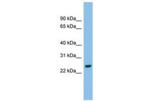Image no. 1 for anti-Adenylate Kinase 2 (AK2) (AA 143-192) antibody (ABIN6744817) (Adenylate Kinase 2 antibody  (AA 143-192))