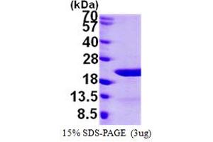 SDS-PAGE (SDS) image for Eukaryotic Translation Initiation Factor 1A, Y-Linked (EIF1AY) (AA 1-144) protein (His tag) (ABIN667872) (EIF1AY Protein (AA 1-144) (His tag))