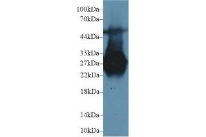 Western Blot; Sample: Rat Liver lysate; Primary Ab: 1µg/ml Rabbit Anti-Rat MBL Antibody Second Ab: 0. (MBL2 antibody  (AA 19-244))