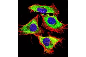 Immunofluorescent analysis of 4 % paraformaldehyde-fixed, 0. (Sonic Hedgehog antibody  (N-Term))