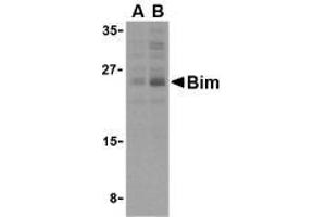 Western blot analysis of Bim in K562 cell lysates with AP30151PU-N Bim antibody (IN2) at (A) 2. (BIM antibody  (Intermediate Domain 2))