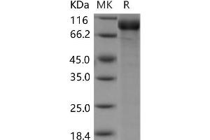 Western Blotting (WB) image for Sema Domain, Seven thrombospondin Repeats (Type 1 and Type 1-Like), Transmembrane Domain (TM) and Short Cytoplasmic Domain, (Semaphorin) 5A (SEMA5A) protein (His tag) (ABIN7320088) (SEMA5A Protein (His tag))