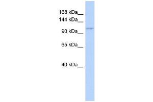 WB Suggested Anti-ZC3H7B Antibody Titration: 0. (ZC3H7B antibody  (Middle Region))