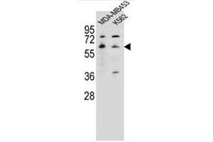 Western blot analysis of HTR3A Antibody (N-term) in MDA-MB453, K562 cell line lysates (35ug/lane). (Serotonin Receptor 3A antibody  (N-Term))