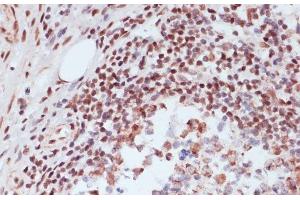 Immunohistochemistry of paraffin-embedded Human appendix using Phospho-CREB1(S133) Polyclonal Antibody at dilution of 1:100 (40x lens). (CREB1 antibody  (pSer133))