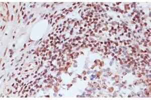 Immunohistochemistry of paraffin-embedded Human appendix using Phospho-CREB1(S133) Polyclonal Antibody at dilution of 1:100 (40x lens). (CREB1 antibody  (pSer133))