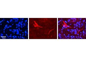 Rabbit Anti-OGT Antibody     Formalin Fixed Paraffin Embedded Tissue: Human Pineal Tissue  Observed Staining: Cytoplasmic in processes of pinealocytes and endothelial cells in blood vessels  Primary Antibody Concentration: 1:100  Other Working Concentrations: 1/600  Secondary Antibody: Donkey anti-Rabbit-Cy3  Secondary Antibody Concentration: 1:200  Magnification: 20X  Exposure Time: 0. (OGT antibody  (N-Term))
